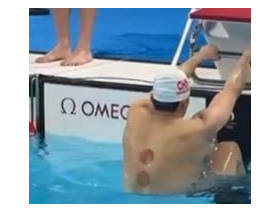 中国游泳队身现火罐印，网友热议“东方神秘力量”